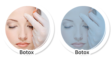 Botox Szczecin