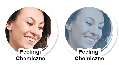 Peelingi chemiczne